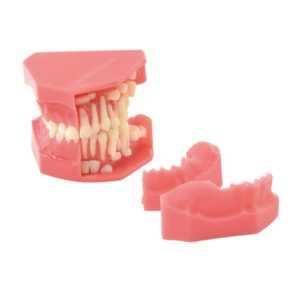 Model zubů dítěte s odnímatelnými dásněmi