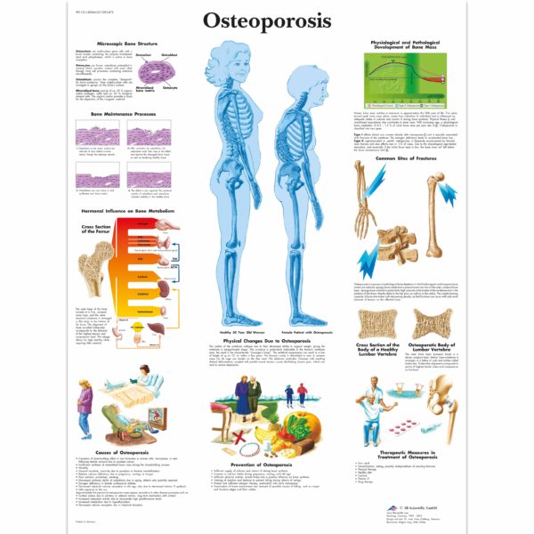 Zalaminované schéma osteoporózy