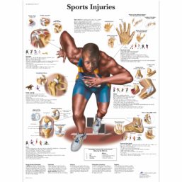 Zalaminované schéma sportovních zranění