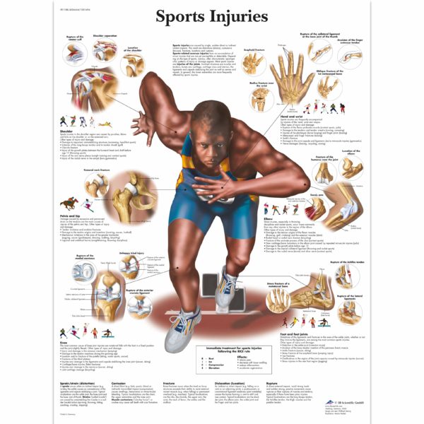 Zalaminované schéma sportovních zranění
