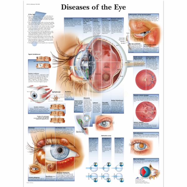 Zalaminované schéma onemocnění oka