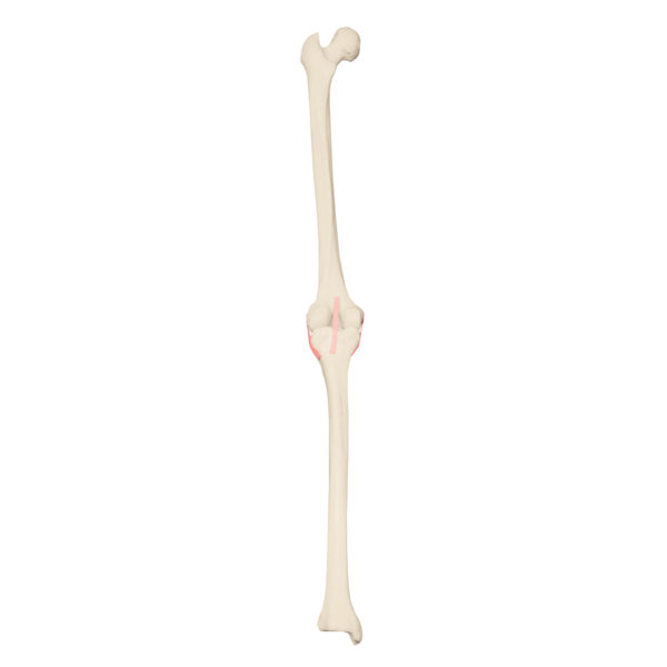Kostní replika levého kolene