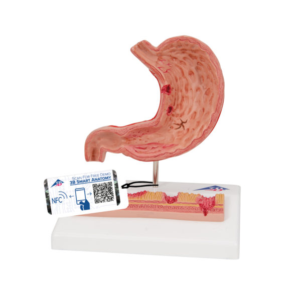 Model lidského žaludku
