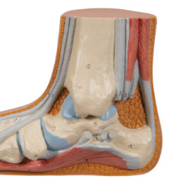 Model lidské nohy s plochým chodidlem