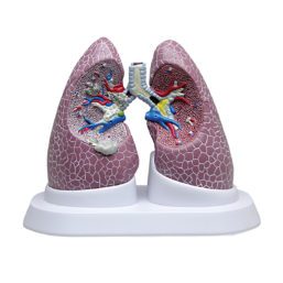 Anatomický model poškozených plic