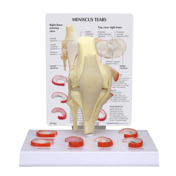 Model kolene s vazy a rupturami menisků