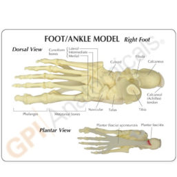 Anatomický model nohy a kotníku s plantární fascitídou