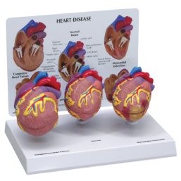 Set modelů nemocného srdce