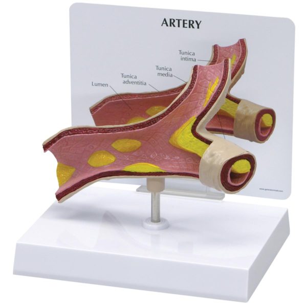 Model poškozené arterie