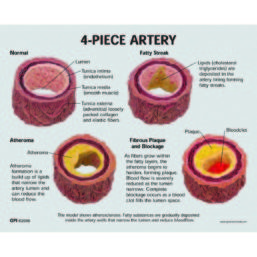 Model aterosklerotické arterie