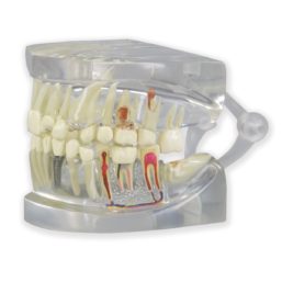 Průhledný model lidské čelisti se zuby
