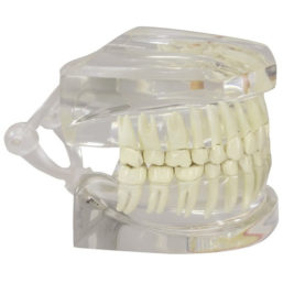 Průhledný model lidské čelisti se zuby