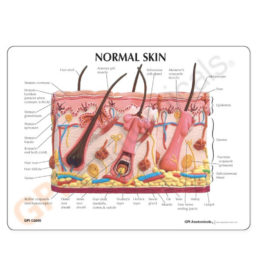 Anatomický model popálené a zdravé kůže