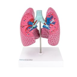Model onemocnění plic